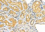 SERPINA2 Polyclonal Antibody