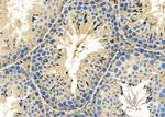 SERPINA2 Antibody in Immunohistochemistry (Paraffin) (IHC (P))