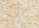SERPINA2 Antibody in Immunohistochemistry (Paraffin) (IHC (P))
