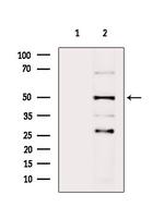 SERPINA2 Antibody in Western Blot (WB)