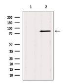CTNNAL1 Polyclonal Antibody