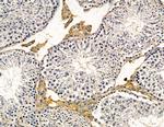 C3orf15 Antibody in Immunohistochemistry (Paraffin) (IHC (P))