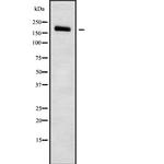 PDS5B Polyclonal Antibody