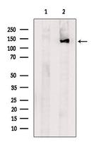 SLC4A2 Antibody in Western Blot (WB)