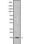 APOC4 Antibody in Western Blot (WB)