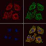 Aquaporin 11 Polyclonal Antibody