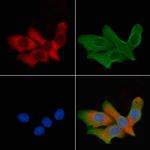 Aquaporin 6 Polyclonal Antibody