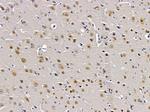 A2BP1 Polyclonal Antibody