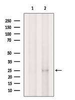 MT-ATP6 Antibody in Western Blot (WB)