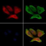 ATP5G1 Polyclonal Antibody