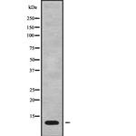 MT-ATP8 Antibody in Western Blot (WB)