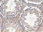ABCC11 Antibody in Immunohistochemistry (Paraffin) (IHC (P))