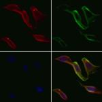 SUR1 Polyclonal Antibody
