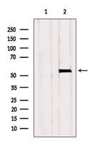 GCNT4 Polyclonal Antibody