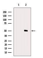 B3GALT2 Antibody in Western Blot (WB)