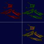 B3GALT6 Polyclonal Antibody