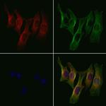 B4GALT2 Polyclonal Antibody