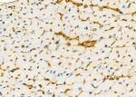 B4GALT4 Antibody in Immunohistochemistry (Paraffin) (IHC (P))