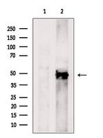 B4GALT6 Polyclonal Antibody
