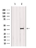 B4GALT7 Antibody in Western Blot (WB)