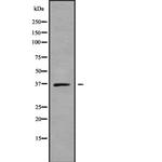SLC25A14 Antibody in Western Blot (WB)