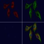 BSSP4 Polyclonal Antibody