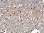 BCAS3 Polyclonal Antibody