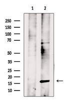 PPP3R1 Polyclonal Antibody