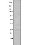 CABP2 Polyclonal Antibody