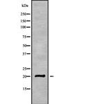 CABP5 Antibody in Western Blot (WB)