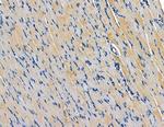 CAB39L Antibody in Immunohistochemistry (Paraffin) (IHC (P))