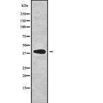CAB39L Antibody in Western Blot (WB)