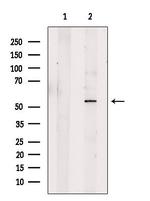 CABYR Polyclonal Antibody