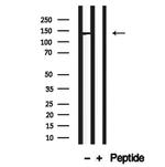 CADPS2 Polyclonal Antibody