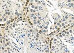 CAMTA2 Antibody in Immunohistochemistry (Paraffin) (IHC (P))