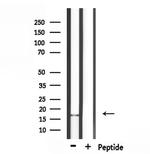 CALML3 Polyclonal Antibody