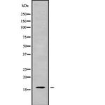 CALML5 Polyclonal Antibody