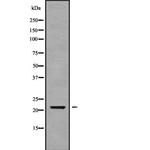 CALML6 Polyclonal Antibody