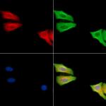 CAPNS2 Polyclonal Antibody