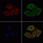 Calponin 3 Polyclonal Antibody