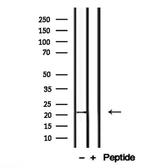 CTAG2 Polyclonal Antibody