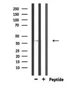 CHST11 Polyclonal Antibody