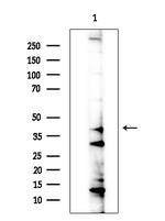 CHST3 Antibody in Western Blot (WB)