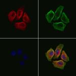 CA7 Polyclonal Antibody