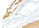 CA7 Antibody in Immunohistochemistry (Paraffin) (IHC (P))