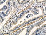 CPXM2 Antibody in Immunohistochemistry (Paraffin) (IHC (P))