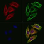 CEACAM20 Polyclonal Antibody