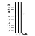 CEACAM20 Antibody in Western Blot (WB)