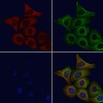 CEACAM7 Polyclonal Antibody