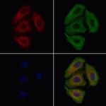 CATSPER3 Polyclonal Antibody